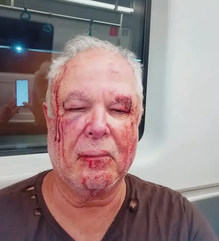 Petista de 69 anos é espancado por motivação política