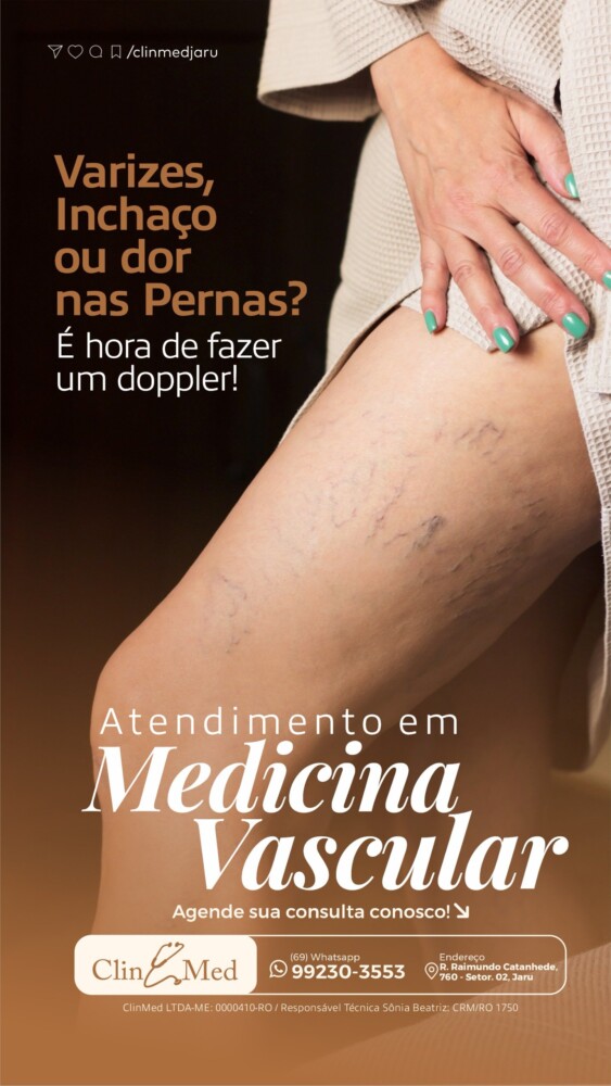 ClinMed destaca a importância do Doppler para quem apresenta varizes, inchaço ou dores nas pernas em Jaru